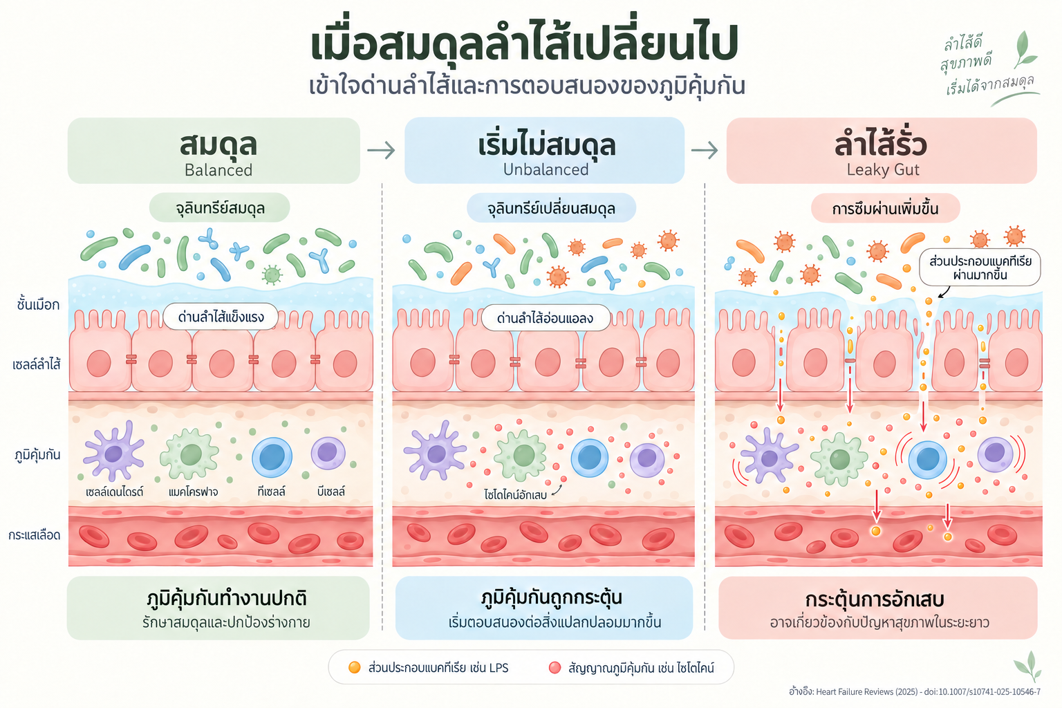 ภาพแสดงผนังลำไส้ในภาวะสมดุล เริ่มไม่สมดุล และลำไส้รั่ว